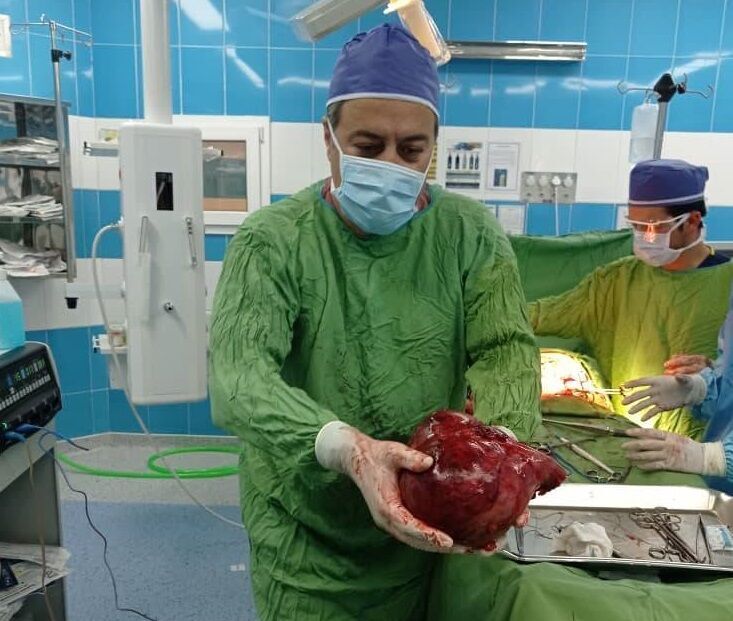 تصویر لحظه خارج کردن توده ۳/۵ کیلویی از کلیه یک بیمار در تربت حیدریه! | تومور بزرگ از شکم بیمار ۵۱ ساله خارج شد