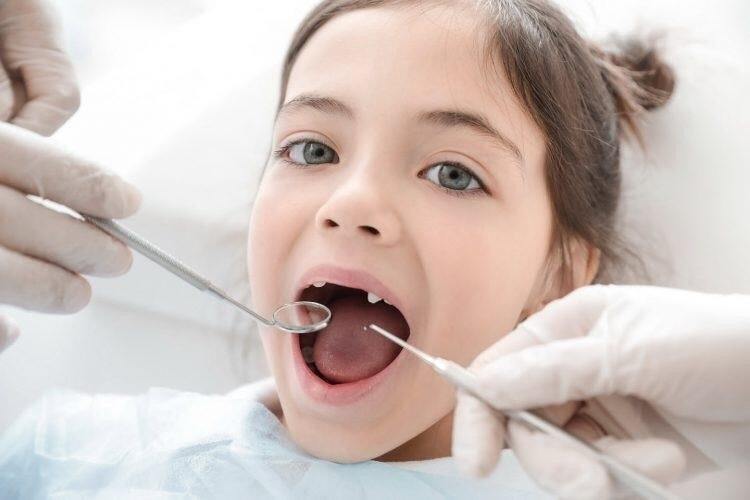 زمان و ترتیب افتادن دندان شیری + جدول | اهمیت دندان شیری و تاثیر آنها روی دندان های دائمی