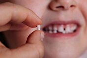 زمان و ترتیب افتادن دندان شیری + جدول | هر فرد چند دندان شیری و چند دندان دائمی دارد؟ | اهمیت دندان شیری و تاثیر آنها روی دندان‌های دائمی